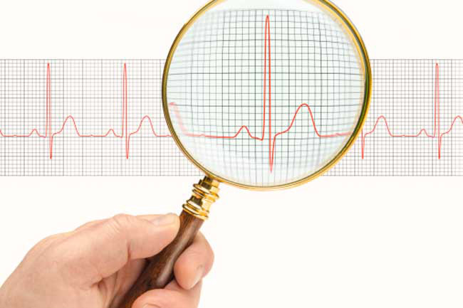 Tim đập nhanh: Trong các trường hợp say nắng, nhịp tim của bạn có thể tăng hoặc giảm đáng kể. Điều này là do nhiệt độ tạo một áp lực lớn lên tim để làm mát cơ thể.