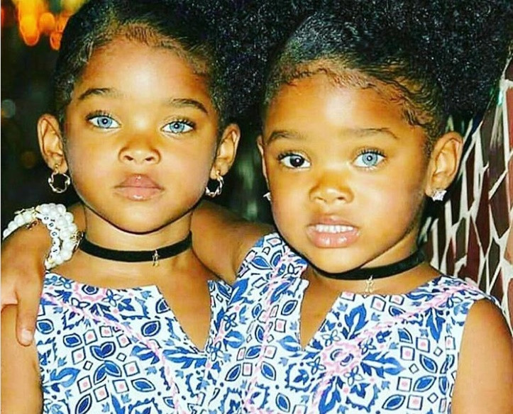 Cặp chị em song sinh Megan và Morgan Boyd có đôi mắt xanh đặc biệt.