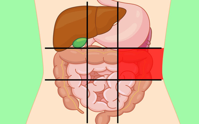 Vị trí giữa ở phía bên trái: Ngoài thận trái, khu vực này cũng chứa đại tràng. Cơn đau có thể do đại tràng bị nhiễm trùng hoặc viêm do chế độ ăn uống không lành mạnh, lão hóa... Đau bụng liên tục và kéo dài kèm sốt, buồn nôn và nôn là những triệu chứng điển hình của viêm túi thừa hoặc viêm đại tràng.
