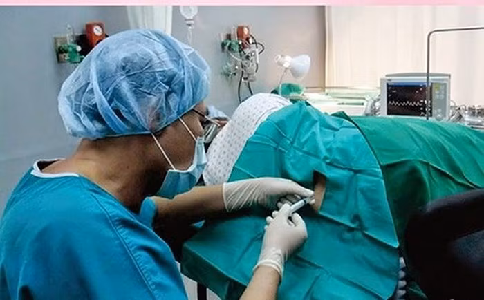 Yen Bai: Dieu tra vu san phu tu vong sau de mo co gay te tuy song-Hinh-2