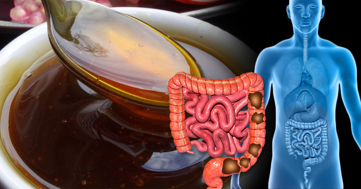 Uống trà mật ong-chanh.: Pha trà bằng cách thêm mật ong và chanh vào nước. Mật ong là thuốc nhuận tràng và cũng giúp làm giảm độ chua của trà do chanh gây ra. Chanh hoạt động như một chất kích thích tự nhiên cho hệ thống tiêu hóa và giúp loại bỏ độc tố khỏi cơ thể.