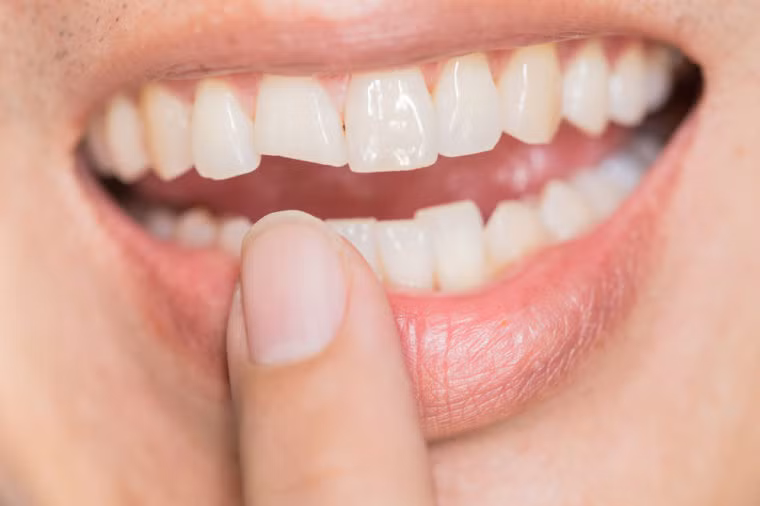 Rang mieng “do chung” the nay, den nha si ngay!-Hinh-3