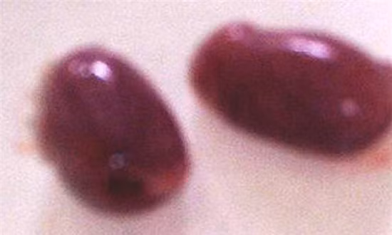 4. Tinh hoàn chuột cống cỏ: Đây được xem là liều thuốc tráng dương tự nhiên của người dân Tây Nam Bộ, Việt Nam. Khi bắt được những chú chuột đồng, người ta tiến hành lột sạch da, lấy phần thịt trắng phau như thịt gà để chế biến món ăn. Trong khi bộ lòng được vứt bỏ thì hai viên tinh hoàn được giữ lại. Món ăn được thưởng thức sống, mang lại cảm giác sền sệt, béo ngậy.