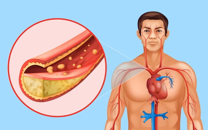 Kiểm soát mức cholesterol: Một nghiên cứu cho thấy tiêu thụ 3 muỗng bột hạt lanh mỗi ngày trong 3 tháng có thể làm giảm 20% cholesterol xấu và cholesterol toàn phần gần 17%. Theo các nhà khoa học, điều này là do lượng chất xơ cao trong hạt lanh.