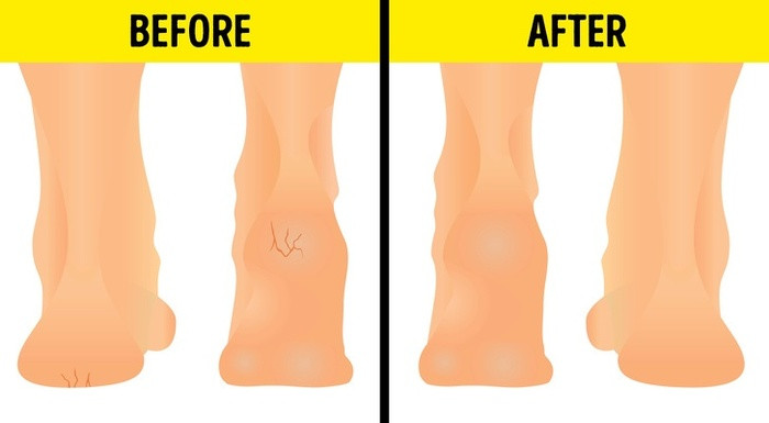 Cuốn hỗn hợp mật ong và lô hội: Kết hợp hai nguyên liệu này có thể giúp làm mềm, mịn các vùng da thô ráp như gót chân, khuỷu tay...Cách làm: Tách riêng phần thịt của lô hội tươi, đem trộn cùng mật ong theo tỷ lệ 1:1. Thêm vào hỗn hợp một chút sữa chua. Thoa đều lên da rồi quấn nilon trong khoảng 30 phút.