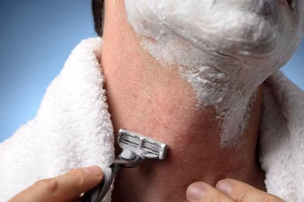 Vết sưng không tan - Một số người nghĩ đó là mụn hay vế sưng do dao cạo. Một số người khác lại nhận thấy đó là những vết xước hay sẹo mà họ không nhớ là đã gặp phải từ khi nào. Những vết sưng có phần bí ẩn này có thể là ung thư biểu mô tế bào, một dạng ung thư da có thể gặp phải ở cả nam giới và phụ nữ, nhưng chúng có thể điều trị được. Nó có thể xuất hiện ở da đầu, mí mắt, vành tai hay ở lưng… Dù không có xu hướng gây di căn nhanh như các khối u ác tính, nhưng nếu càng để lâu, các vết sẹo sẽ càng trở nên xấu xí.