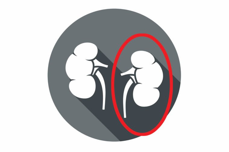 Chúng ta có thể sống tốt với chỉ một trong hai quả thận. Cho dù buộc phải phẫu thuật cắt bỏ hay vì hiến tặng một quả thận cho một người khác thì hầu hết mọi người vẫn sống khỏe mạnh bình thường với quả thận còn lại.