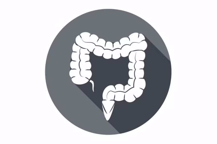 Khi ruột già hay đại tràng bị cắt bỏ, bệnh nhân có thể phải mang một túi bên ngoài để chứa phân. Vì phân không thể di chuyển xuống hậu môn như bình thường, bác sĩ sẽ phải tạo ra một chỗ thoát hay hậu môn nhân tạo, trên thành bụng.