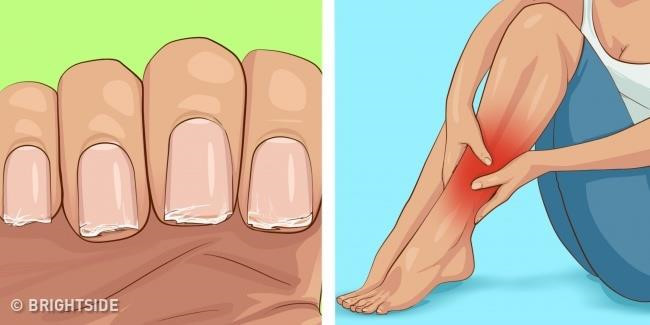 Thiếu vitamin: Các axit photphoric trong nước ngọt kết hợp với chất lợi tiểu caffeine sẽ loại bỏ các chất dinh dưỡng và vitamin ra khỏi cơ thể chỉ 60 phút sau khi uống. Hãy tưởng tượng nếu bạn uống nước ngọt mỗi ngày, cơ thể sẽ ngày càng mất vitamin trầm trọng.