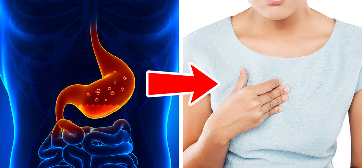 Cà chua có thể gây trào ngược axit: Cà chua rất chua và có thể gây ợ nóng ở những người có vấn đề về dạ dày như viêm dạ dày và trào ngược dạ dày thực quản. Ngay cả khi bạn khỏe mạnh và ăn quá nhiều cà chua hoặc quá nhiều nước sốt cà chua, bạn vẫn có thể cảm thấy sự khó chịu tương tự.