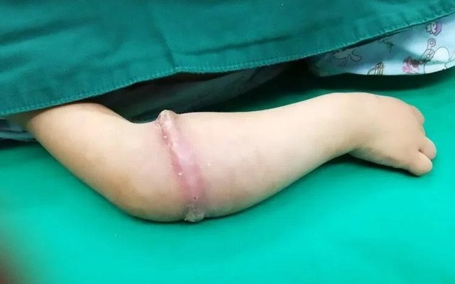 Thoi quen khien tre Viet de gap hoa neu cha me it de y