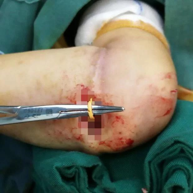 Thoi quen khien tre Viet de gap hoa neu cha me it de y-Hinh-2