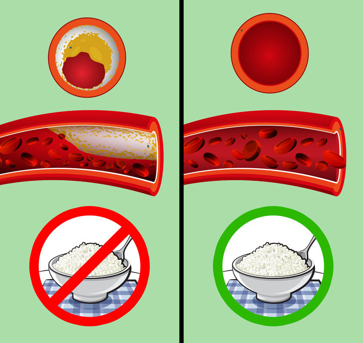 Ngừa bệnh tim mạch: Bên cạnh việc bình thường hóa lượng đường trong máu, magiê trong phô mai có ảnh hưởng tích cực đến hệ thống tim mạch. Nó giữ áp lực động mạch trong tầm kiểm soát và ngăn ngừa sự xuất hiện của cục máu đông.