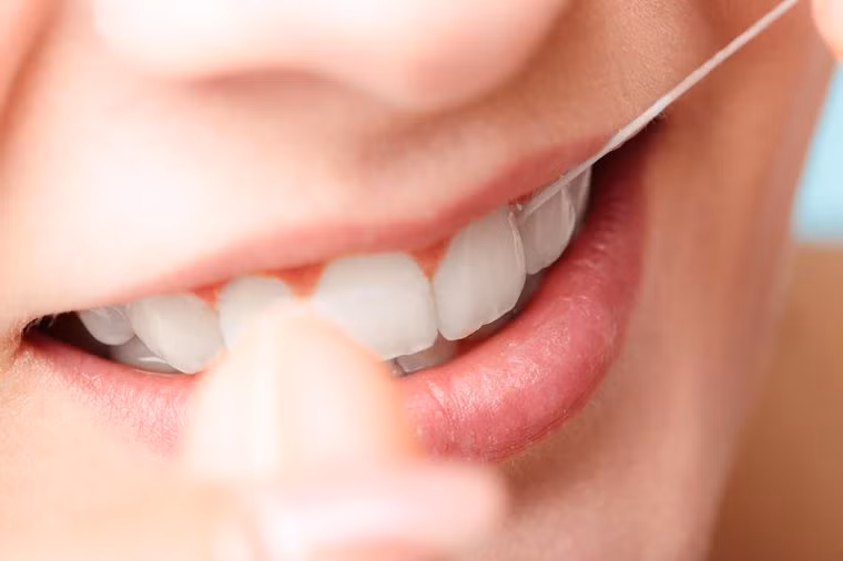 4. Không đánh răng hoặc dùng chỉ nha khoa đều đặn: Răng nhiều mảng bám sẽ có nhiều nguy cơ, bao gồm sâu răng, viêm nướu, nhiễm trùng nặng, bệnh tim mạch, suy dinh dưỡng, đặc biệt là ở người già. Đánh răng 2 lần mỗi ngày, dùng chỉ nha khoa mỗi ngày 1 lần và gặp nha sĩ thường xuyên để tránh điều này.