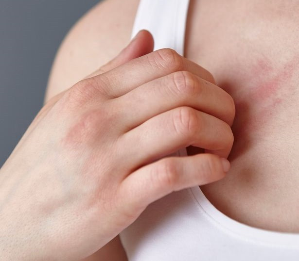 Màu da thay đổi: Tình trạng da nhăn nheo, nhợt nhạt có thể là dấu hiệu của bệnh vàng da. Do sắc tố bilirubin tăng lên trong máu, kéo theo là hiện tượng mắt đỏ. Tốt nhất nếu thấy màu da thay đổi bất thường thì bạn nên đi khám ngay. Ảnh: BS, Internet.