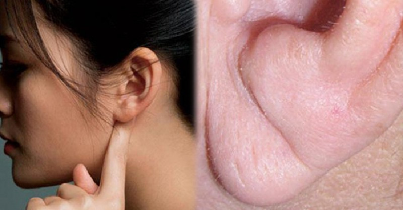 Dái tai có nếp nhăn: Theo một nghiên cứu từ Mỹ, những người có nếp nhăn ở dái tai thường có nguy cơ mắc bệnh tim lên tới 30%. Nếu cả hai bên dái tai đều có nếp nhăn thì nguy cơ mắc bệnh tim mạch có thể lên tới 77%.