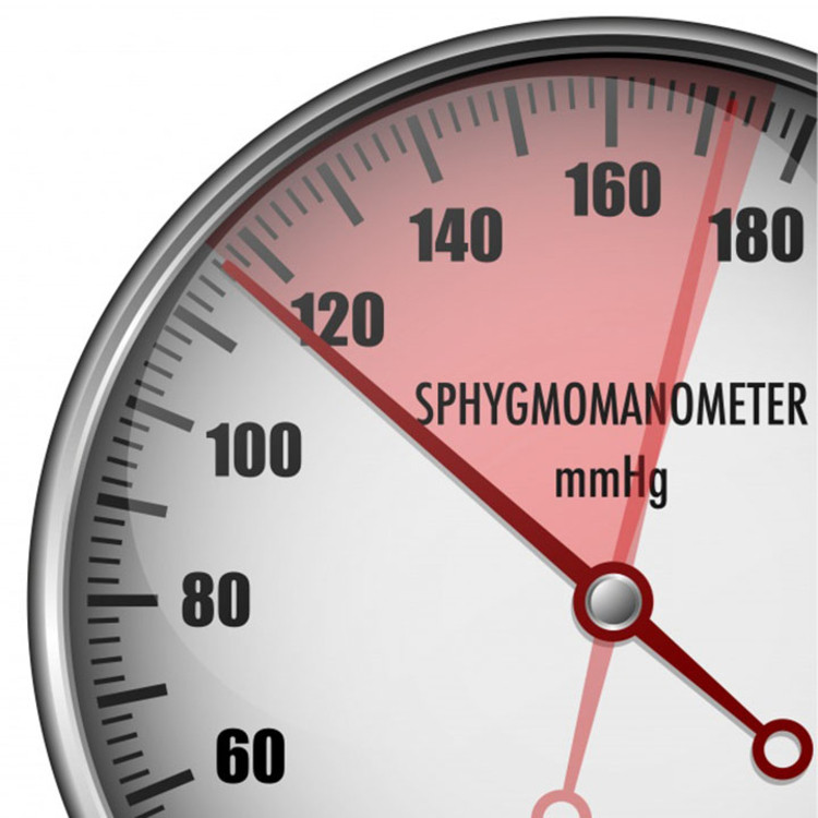 Huyết áp cao: Hệ tuần hoàn và thận của bạn phụ thuộc vào nhau. Thận có chức năng lọc chất thải và chất lỏng thừa từ máu. Nếu các mạch máu bị hư hỏng, nephron lọc máu của bạn không nhận được đủ oxy và chất dinh dưỡng. Đó là lý do tại sao huyết áp cao là nguyên nhân đứng thứ hai gây suy thận. 