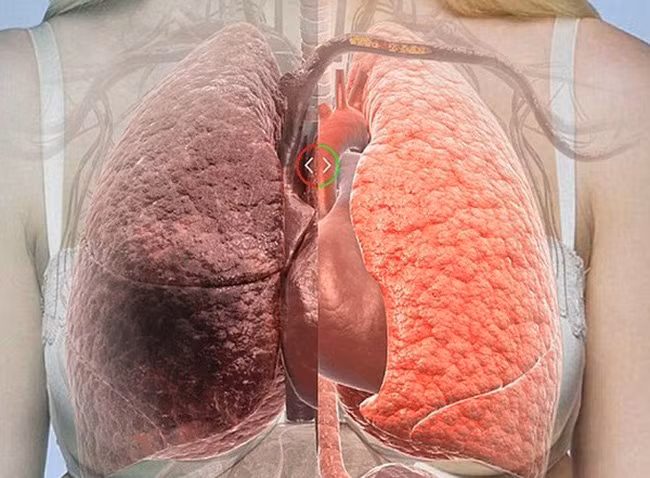 Sau đây là những thực phẩm có tác dụng thanh lọc, giải độc, làm sạch phổi mạnh nhất mà chúng ta nên bổ sung nhiều hơn vào thực đơn ăn uống, đặc biệt là đối với người hút thuốc.