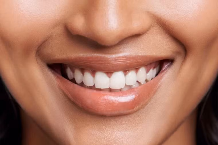 Răng trắng sáng hơn: Cà phê có tính axit cao, nó làm xói mòn men răng, gây ố vàng. Cắt giảm caffeine sẽ giúp bạn bảo vệ hàm răng khỏe mạnh, nụ cười trắng sáng hơn.