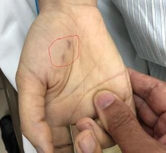 100% ca benh dai deu tu vong do sai lam nguy hai khi bi cho can