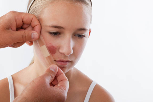 Viêm da: Tinh chất lựu có thể làm dịu da khi da bị viêm nhờ có các polyphenol và các thành phần kháng viêm khác. Các chuyên da chăm sóc sắc đẹp khuyên dùng tinh dầu hạt lựu để điều trị các vết xước nhỏ trên da hoặc để ngăn ngừa sự hình thành sẹo do một vấn đề về da nào đó. 