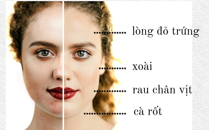 Da dầu: Mỹ phẩm chỉ tạm thời cứu bạn khỏi bóng nhờn do da dầu, trong khi chế độ ăn giàu vitamin A có thể làm giảm đáng kể mức độ dầu trên da. Bạn hãy ăn xoài, cà rốt, lòng đỏ trứng, quả mơ khô, rau bina và khoai lang...