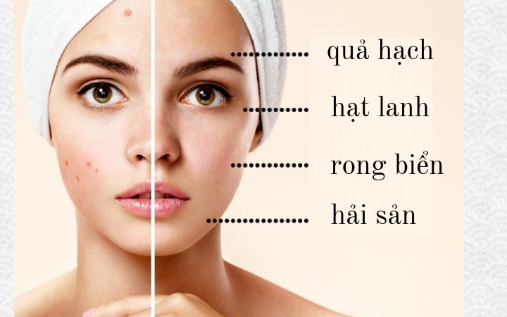 Da bị mụn: Khi các tuyến bã nhờn hoạt động mạnh khiến lỗ chân lông bị bít tắc, vi khuẩn sinh sản nhanh hơn gây viêm da và mụn. Một chế độ ăn uống đặc biệt có thể giúp bạn giải quyết vấn đề mụn trứng cá. Điều quan trọng nhất là bạn cần ăn nhiều thực phẩm có axit béo không bão hòa để làm dịu tình trạng viêm. Bạn cũng có thể ăn thêm trái cây, rau, quả hạch, quả óc chó, hạt lanh, rong biển và hải sản.