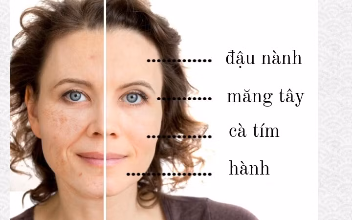 Da lão hóa, nhiều nếp nhăn: Các nhà nghiên cứu Mỹ phát hiện ra rằng, chất chống oxy hóa có thể giúp làn da trẻ hơn. Theo đó, nếu bạn ăn thực phẩm có chứa đậu nành mỗi ngày, các dấu hiệu lão hóa da sẽ gần như biến mất, đặc biệt là các nếp nhăn quanh mắt. Theo các nghiên cứu, với chế độ ăn nhiều rau, đặc biệt là măng tây, cần tây, cà tím, tỏi và hành tây, người Thụy Điển có làn da ít bị lão hóa. Họ ăn hầu như không ăn thịt đỏ, đường, bơ, bơ thực vật hay sữa…