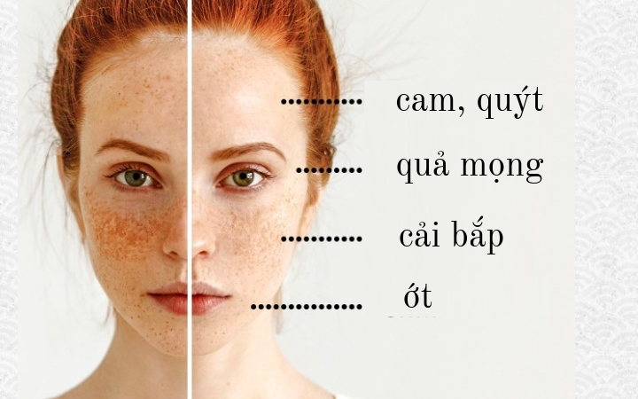 Da tàn nhang: Da bị tăng sắc tố có thể do bạn thiếu vitamin, đặc biệt là B12. Chế độ ăn giàu vitamin B12, C và E cùng các chất chống oxy hóa như axit ellagic có thể giúp bạn thoát khỏi các đốm sắc tố. Các loại trái cây như: cam quýt, dâu tây, kiwi, cà chua và lựu rất giàu những loại vitamin hữu ích này.