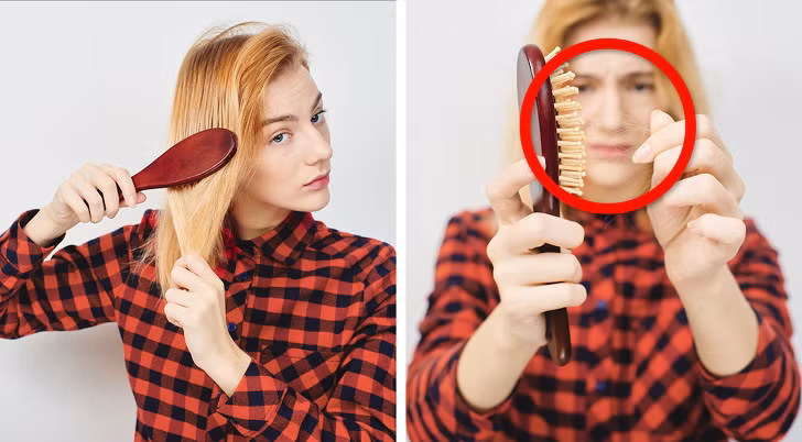 Tóc dễ gãy và dễ rụng: Rụng nhiều tóc rất có thể bạn đang thiếu vitamin C. Ngoài các loại mỹ phẩm chăm sóc tóc, hãy bổ sung các thực phẩm giàu vitamin C như bông cải xanh và kiwi để tóc khỏe từ bên trong.