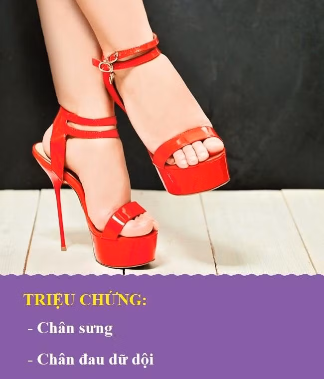 Suy tim: Theo Medical News Today, khi một hoặc hai buồng tim mất khả năng vận chuyển máu hiệu quả, chúng có thể gây tắc nghẽn mạch máu ở các chi dưới. Khi đó, chân sẽ sưng lên và đau dữ dội.