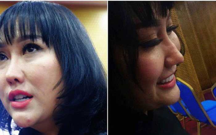 Trước Lệ Quyên, có không ít sao Việt "gặp họa" vì biến chứng hậu phẫu thuật thẩm mỹ. Trước đó, "nữ hoàng dao kéo" Phi Thanh Vân cũng từng gánh chịu hậu quả từ những biến chứng sau phẫu thuật thẩm mỹ. Tại một sự kiện vào tháng 5/2018, Phi Thanh Vân để lộ chiếc cằm biến dạng, sống mũi nhọn hoắt, làn da sần sùi.