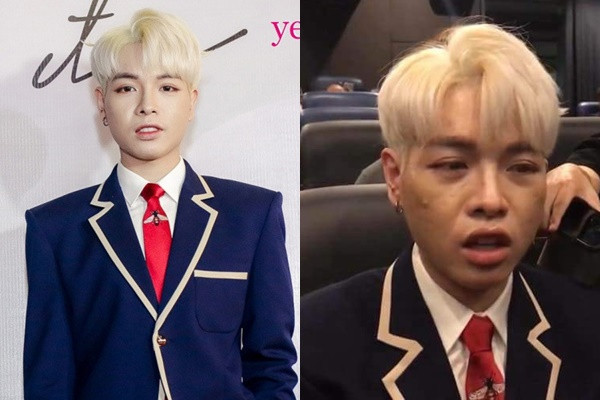 Dù thẩm mỹ khá thành công nhưng Đức Phúc cũng tránh khỏi sự xuống cấp của nhan sắc chỉnh sửa theo thời gian. Trong một sự kiện mới đây, nam ca sĩ xuất hiện với gương mặt chi chít mụn, "xuống cấp" thấy rõ sau 1 năm dao kéo.