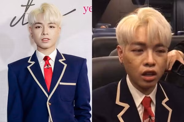 Dù thẩm mỹ khá thành công nhưng Đức Phúc cũng tránh khỏi sự xuống cấp của nhan sắc chỉnh sửa theo thời gian. Trong một sự kiện mới đây, nam ca sĩ xuất hiện với gương mặt chi chít mụn, "xuống cấp" thấy rõ sau 1 năm dao kéo.