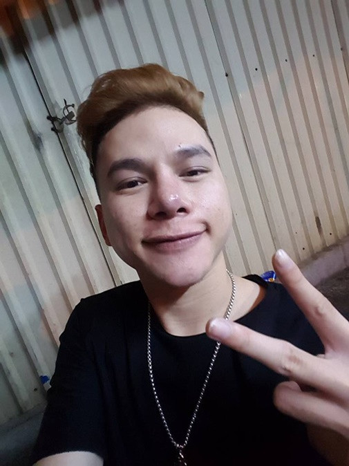 Hoàng Tôn từng gây sốc với hình ảnh chiếc mũi sưng tấy đến mức suýt bị hoại tử. Hai bên cánh mũi dù đã làm gọn nhưng lại cho thấy kết quả lệch lạc. Chiếc cằm Vline cũng có dấu hiệu sưng tấy.