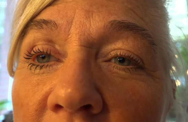 Nguy cơ mù mắt vì kính áp tròng: Các nhà khoa học cảnh báo những người sử dụng kính áp tròng có thể bị mù mắt nếu mắc một loại ký sinh trùng thường được tìm thấy trong nước máy. Ký sinh trùng Acanthamoeba là kẻ thù tiềm ẩn đối với mọi người sử dụng kính áp tròng. Ảnh: Internet.