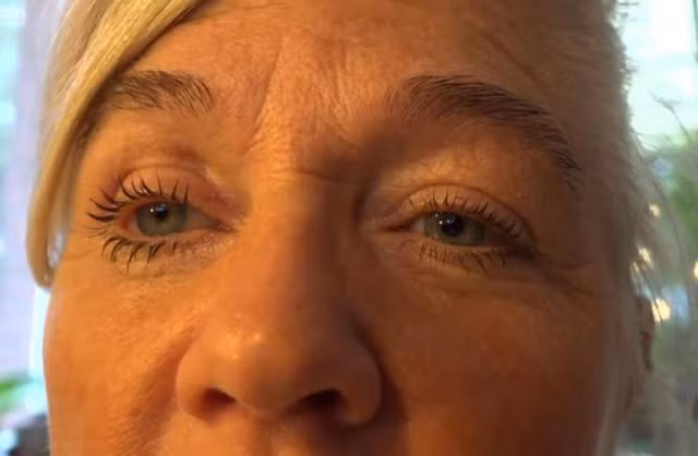 Nguy cơ mù mắt vì kính áp tròng: Các nhà khoa học cảnh báo những người sử dụng kính áp tròng có thể bị mù mắt nếu mắc một loại ký sinh trùng thường được tìm thấy trong nước máy. Ký sinh trùng Acanthamoeba là kẻ thù tiềm ẩn đối với mọi người sử dụng kính áp tròng. Ảnh: Internet.