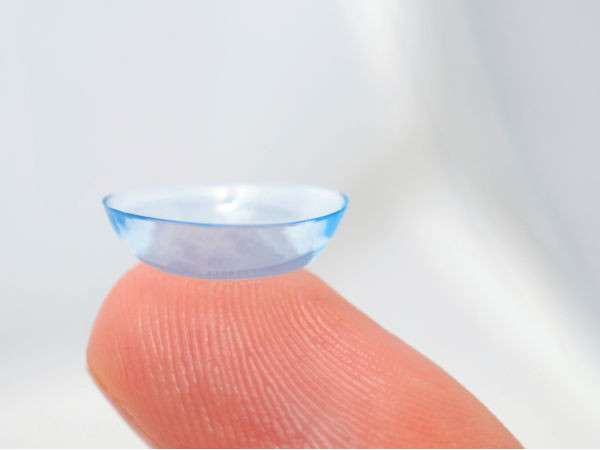 Viêm giác mạc bề mặt: Đây là sự kích thích của lớp ngoài cùng giác mạc, nguyên nhân do các giải pháp chăm sóc kính áp tròng, dị ứng, nhiễm trùng và kích ứng cơ học.