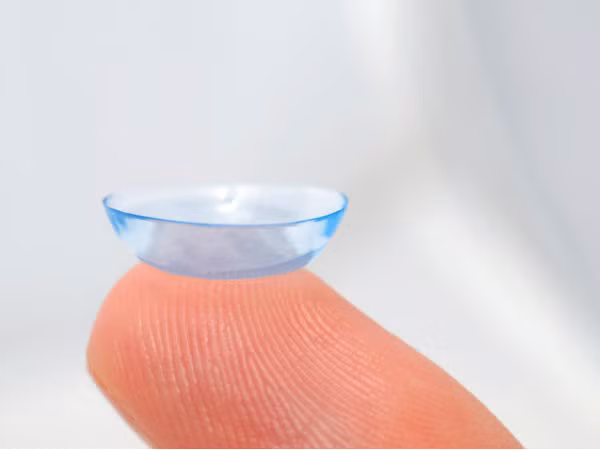 Viêm giác mạc bề mặt: Đây là sự kích thích của lớp ngoài cùng giác mạc, nguyên nhân do các giải pháp chăm sóc kính áp tròng, dị ứng, nhiễm trùng và kích ứng cơ học.