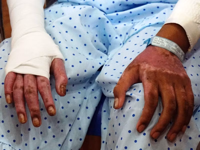 Fan nu trung phao sang CDV Nam Dinh: Di chung, phuc hoi chuc nang ra sao?