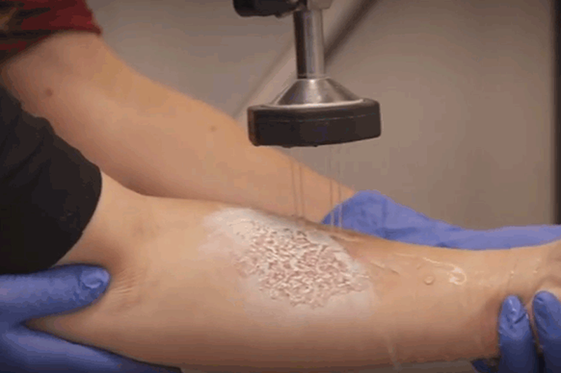 Fan nu trung phao sang CDV Nam Dinh: Bong hoa chat nguy hiem the nao?-Hinh-2