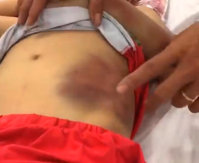 Xot xa nhung vu cha me bao hanh chinh con ruot gay “nong” du luan