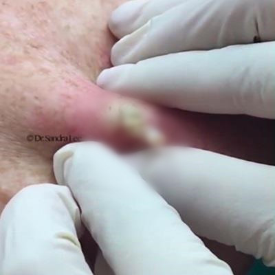 Vi sao nhieu nguoi lai thich xem clip nan mun?-Hinh-3