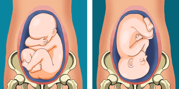 2. Em bé “rơi” : Đối với những mẹ lần đầu mang thai, em bé thường bắt đầu “rơi” xuống vùng xương chậu một vài tuần trước khi có dấu hiệu chuyển dạ (thường khoảng 2-4 tuần). Trong những lần sinh sau, điều này thường không xảy ra nữa. Đây là lúc thai nhi di chuyển đến vị trí thích hợp để sẵn sàng ra ngoài. Lúc này, mẹ sẽ cảm thấy cơ thể “lạch bạch” hơn, do thai nhi đẩy xuống ép bàng quang nên mẹ thường buồn vệ sinh nhiều.