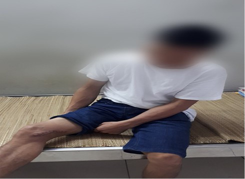 Ngày 15/9, Bệnh viện Trung ương Thái Nguyên cho hay, bệnh viện vừa tiếp nhận và điều trị cho một nam bệnh nhân tên là M.V.D (45 tuổi trú tại La Hiên, Võ Nhai, Thái Nguyên) bị mắc bệnh Whitmore (hay còn gọi là vi khuẩn “ăn thịt người"). Ảnh: Infonet.