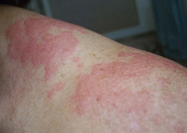 Nang nong 40 do gay hai gi cho suc khoe va nen an mac the nao?-Hinh-5