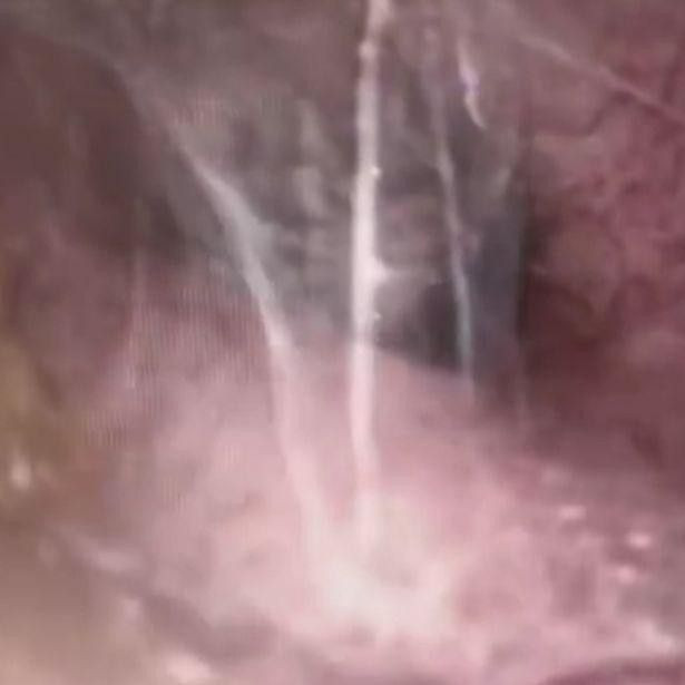 Ki sinh trung: Rung minh nhung truong hop sinh vat la cu tru tai day-Hinh-4