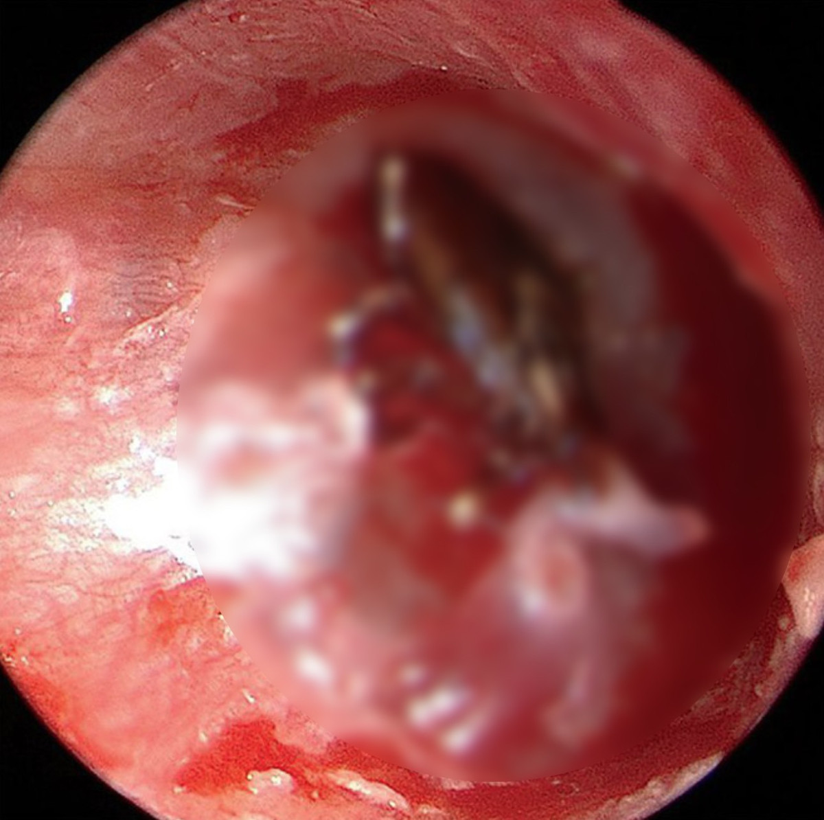 Ki sinh trung: Rung minh nhung truong hop sinh vat la cu tru tai day-Hinh-2