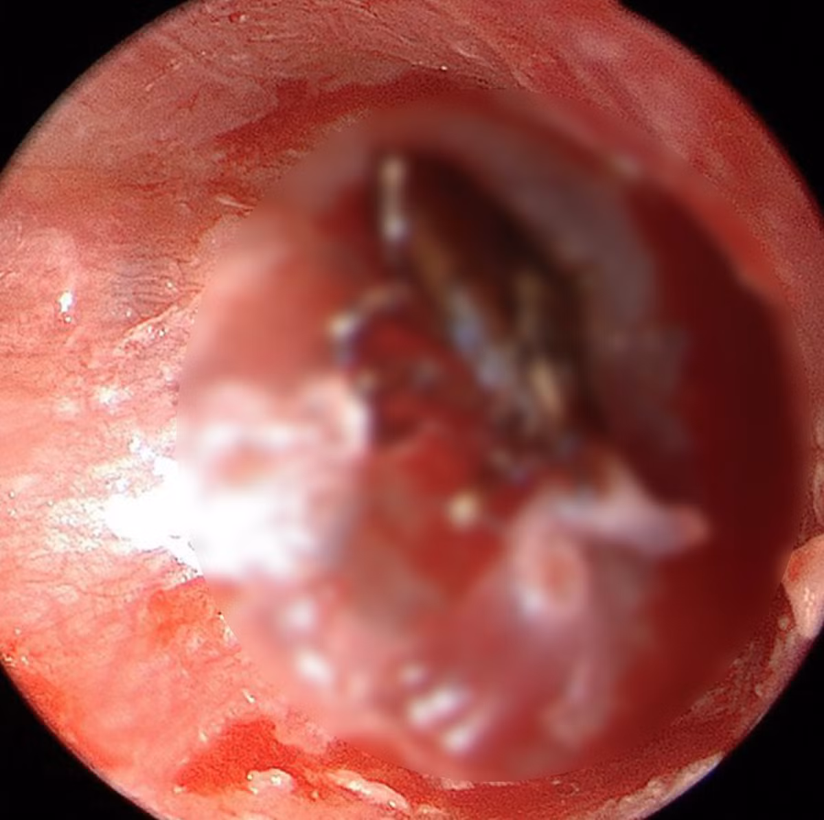 Kí sinh trùng: Rùng mình những trường hợp sinh vật lạ cư trú tại đây - Hình 2 Ki sinh trung: Rung minh nhung truong hop sinh vat la cu tru tai day-Hinh-2