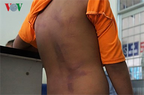 4 hoc sinh bi danh bam tim o Ca Mau duoc ban giao cho cha me